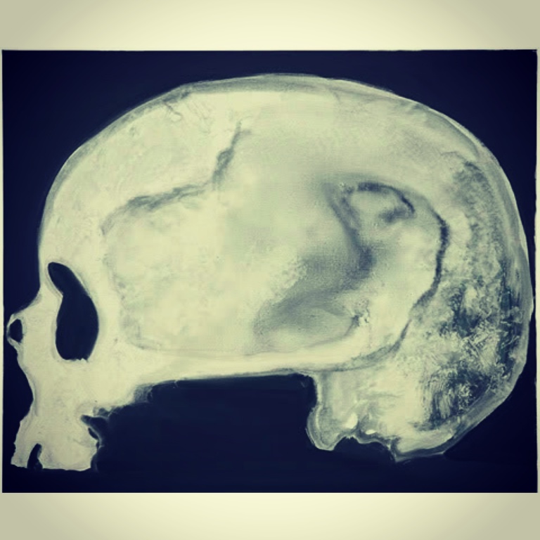 Skull (of a woman), 2005 by Marlene Dumas